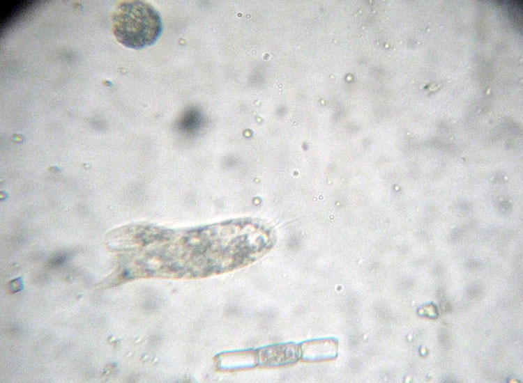 Prove di identificazione di protozoo: Spiretella plancticola